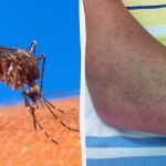 O infecție tropicală periculoasă amenință aproape toată Europa - The