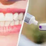 Cu sau fără fluorură: medicul dentist a răspuns clar care